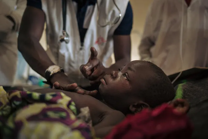 Meisje is opgenomen voor behandeling voor mazelen door Artsen zonder Grenzen in DR Congo.