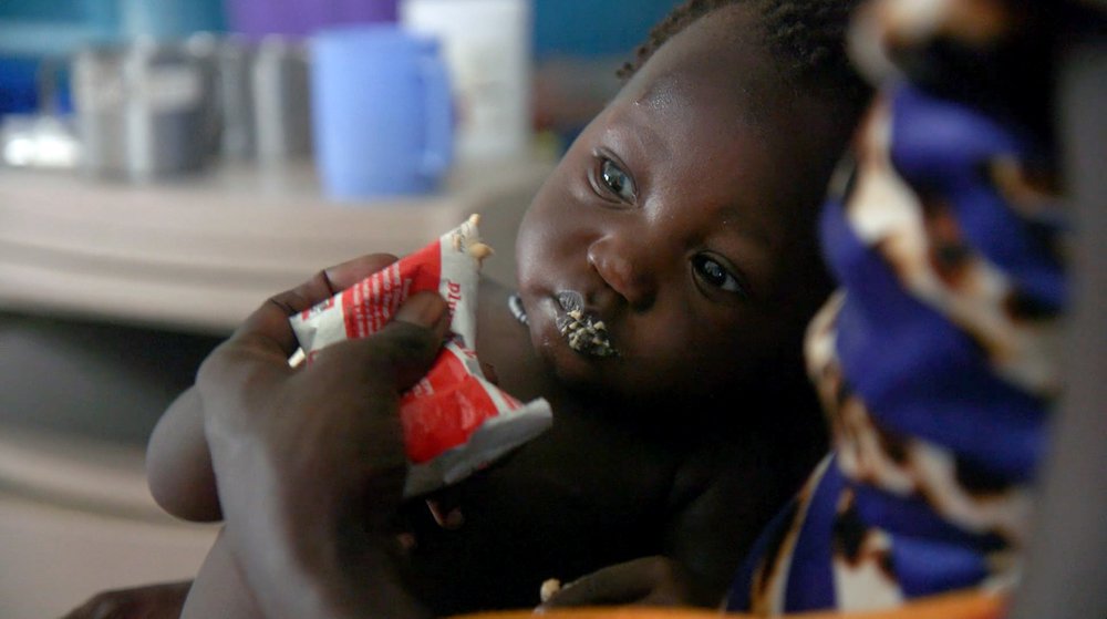 Ondervoeding in Pibor, Zuid-Soedan