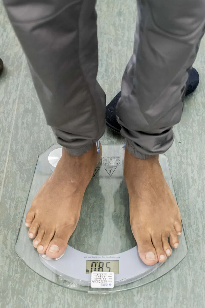 Resistente tuberculosepatient op weegschaal zuid-afrika