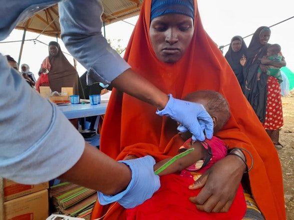 Het armpje van baby Samira wordt opgemeten. Het kindje heeft koorts en veel gewicht verloren de afgelopen tijd