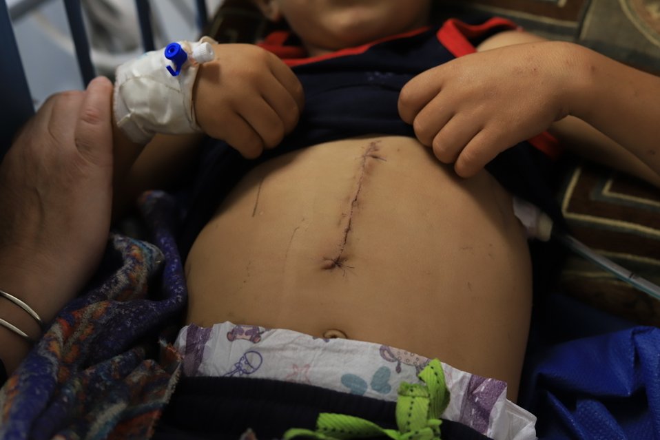 Een klein kind in Gaza met verwondingen van beschietingen van het Israëlische leger.