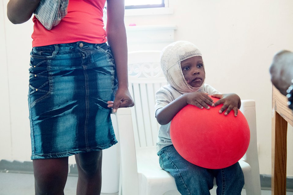 Een kind bezoekt met zijn moeder een brandwondencentrum van Artsen zonder Grenzen in Haïti.