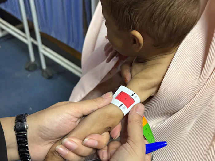 Een verpleegkundige gebruikt een meetlint om de bovenarm van een baby op te meten tijdens een medische controle op ondervoeding in Afghanistan.