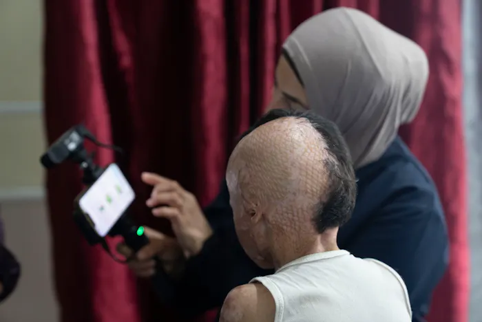 3D masker in Gaza